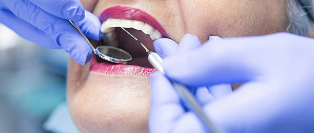 Best Emergency Root Canal Treatment in China Spring, TX